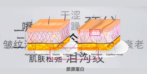 星空体育平台官网：Avon雅芳新活「粉绷带¹」强势来袭 突破胶原焕活局限引领科技护肤新纪元(图2)